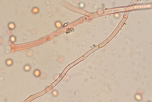 Phanerochaete aff. sanguineocarnosa